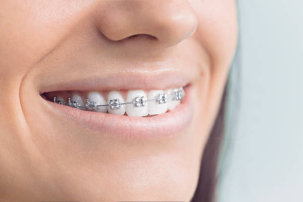 Best Veneers and Lumineers  in Tylertown, MS